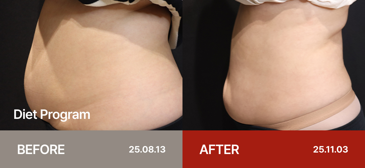 Ollium Diet Program before&after 2